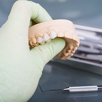 Dentist holding model of patients teeth - Restorative Dentistry in Dallas TX