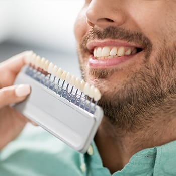 Man having teeth color matched to veneer shades at Cosmetic Dentistry Dental Office - Dallas, TX