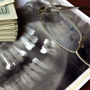 An image of a jaw x-ray with glasses and a stack of money.