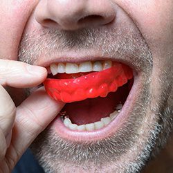 man removing a mouth guard from his teeth